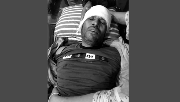 নড়াইলে প্রতিপক্ষের হামলায় যুবকের হাত-পা বিচ্ছিন্ন