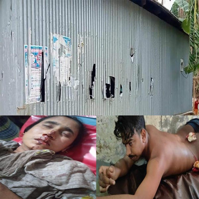 নড়াইলে যুবকের পায়ের রগ কর্তন দুপক্ষের সংঘর্ষে মহিলা সহ যুবক আহত, আটক-১